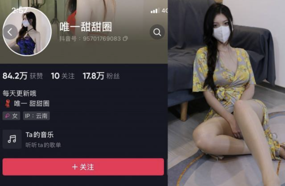 唯一甜甜圈 微密圈合集[8套][持续更新]-瞬颜部落