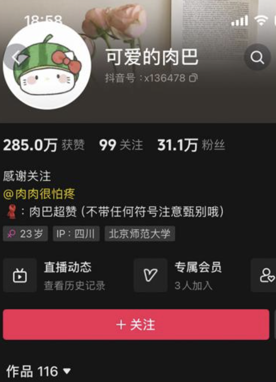 可爱的肉巴 微密圈资源合集下载[27套][持续更新]-瞬颜部落
